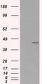 Protein Kinase CAMP-Dependent Type I Regulatory Subunit Alpha antibody, TA500641S, Origene, Western Blot image 