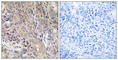 Lysosomal Associated Membrane Protein 3 antibody, abx014565, Abbexa, Western Blot image 