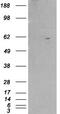 Retinoid X Receptor Beta antibody, GTX89670, GeneTex, Western Blot image 