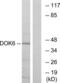 Docking Protein 6 antibody, LS-B9964, Lifespan Biosciences, Western Blot image 