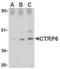 C1q And TNF Related 6 antibody, GTX85668, GeneTex, Western Blot image 