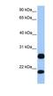 Arginine And Serine Rich Protein 1 antibody, NBP1-70455, Novus Biologicals, Western Blot image 