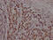 Androgen Receptor antibody, CSB-RA217661A0HU, Cusabio, Immunohistochemistry paraffin image 