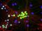 Neurofilament Medium antibody, GTX30441, GeneTex, Immunocytochemistry image 