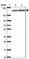 ATP Binding Cassette Subfamily A Member 9 antibody, PA5-63027, Invitrogen Antibodies, Western Blot image 