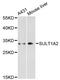 Sulfotransferase Family 1A Member 2 antibody, A05054, Boster Biological Technology, Western Blot image 