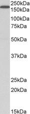 Low-density lipoprotein receptor-related protein 5 antibody, LS-C47561, Lifespan Biosciences, Western Blot image 