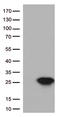 Cancer/Testis Antigen 1B antibody, LS-C796740, Lifespan Biosciences, Western Blot image 