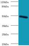 C-Type Lectin Domain Family 18 Member A antibody, MBS1488998, MyBioSource, Western Blot image 