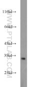 Penta-EF-Hand Domain Containing 1 antibody, 10151-1-AP, Proteintech Group, Western Blot image 