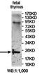 RAB8B, Member RAS Oncogene Family antibody, orb78155, Biorbyt, Western Blot image 
