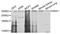 Nuclear Receptor Binding SET Domain Protein 1 antibody, A9981, ABclonal Technology, Western Blot image 