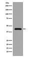 Mitogen-Activated Protein Kinase Kinase 1 antibody, M00292, Boster Biological Technology, Western Blot image 