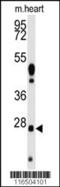 WDYHV Motif Containing 1 antibody, 61-520, ProSci, Western Blot image 