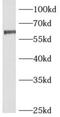 ADP Ribosylation Factor GTPase Activating Protein 2 antibody, FNab00537, FineTest, Western Blot image 