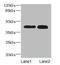 Cathepsin L antibody, A50161-100, Epigentek, Western Blot image 