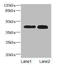 Cathepsin L1 antibody, A50161-100, Epigentek, Western Blot image 