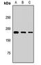 Alsin Rho Guanine Nucleotide Exchange Factor ALS2 antibody, orb412549, Biorbyt, Western Blot image 