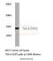 TNF Alpha Induced Protein 6 antibody, A03433, Boster Biological Technology, Western Blot image 