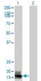 Guanylate Cyclase Activator 1A antibody, H00002978-M04, Novus Biologicals, Western Blot image 