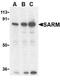 SARM1 antibody, TA306162, Origene, Western Blot image 