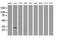 Glutathione S-Transferase Theta 2 (Gene/Pseudogene) antibody, MA5-25270, Invitrogen Antibodies, Western Blot image 