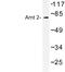 Aryl Hydrocarbon Receptor Nuclear Translocator 2 antibody, LS-C176950, Lifespan Biosciences, Western Blot image 