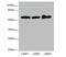 Keratin 6A antibody, A57041-100, Epigentek, Western Blot image 