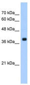 Farnesyltransferase, CAAX Box, Alpha antibody, TA346689, Origene, Western Blot image 