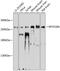 Myosin XVIIIA antibody, 23-775, ProSci, Western Blot image 
