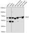 Pyruvate Kinase L/R antibody, 14-251, ProSci, Western Blot image 