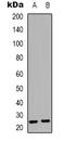 Syndecan 4 antibody, LS-C368809, Lifespan Biosciences, Western Blot image 