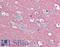 Synaptosome Associated Protein 25 antibody, LS-B2464, Lifespan Biosciences, Immunohistochemistry paraffin image 