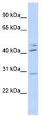 Spi-C Transcription Factor antibody, TA345536, Origene, Western Blot image 