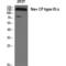 Sodium Voltage-Gated Channel Alpha Subunit 9 antibody, LS-C384755, Lifespan Biosciences, Western Blot image 