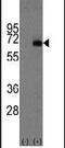 Alpha Fetoprotein antibody, PA5-11481, Invitrogen Antibodies, Western Blot image 