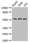 Sprouty Related EVH1 Domain Containing 1 antibody, orb53551, Biorbyt, Western Blot image 