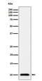 Ubiquitin A-52 Residue Ribosomal Protein Fusion Product 1 antibody, M04905-1, Boster Biological Technology, Western Blot image 