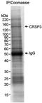 Mediator of RNA polymerase II transcription subunit 23 antibody, A300-423A, Bethyl Labs, Immunoprecipitation image 