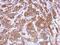 Murine Retrovirus Integration Site 1 Homolog antibody, PA5-32111, Invitrogen Antibodies, Immunohistochemistry paraffin image 
