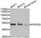 6-Phosphofructo-2-Kinase/Fructose-2,6-Biphosphatase 3 antibody, STJ29025, St John