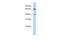 RB Binding Protein 5, Histone Lysine Methyltransferase Complex Subunit antibody, PA5-40843, Invitrogen Antibodies, Western Blot image 