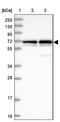Trophinin Associated Protein antibody, NBP1-92532, Novus Biologicals, Western Blot image 