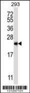 RAB1B, Member RAS Oncogene Family antibody, 57-284, ProSci, Western Blot image 