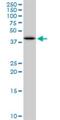 Sulfotransferase family cytosolic 2B member 1 antibody, H00006820-M03, Novus Biologicals, Western Blot image 