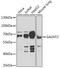 Polypeptide N-Acetylgalactosaminyltransferase 2 antibody, GTX55634, GeneTex, Western Blot image 