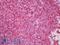 CD20 antibody, LS-B8650, Lifespan Biosciences, Immunohistochemistry frozen image 
