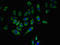 CD5 Molecule antibody, LS-C671205, Lifespan Biosciences, Immunofluorescence image 