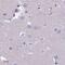 UPII antibody, PA5-60318, Invitrogen Antibodies, Immunohistochemistry paraffin image 