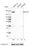 ATPase Family AAA Domain Containing 2 antibody, NBP2-14786, Novus Biologicals, Western Blot image 